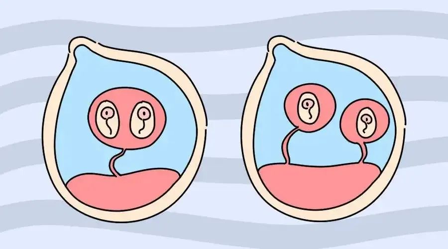【孕育科普】出现胎心胎芽还会胎停，可能跟这些原因有关！